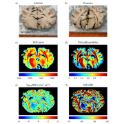 Images of the brain