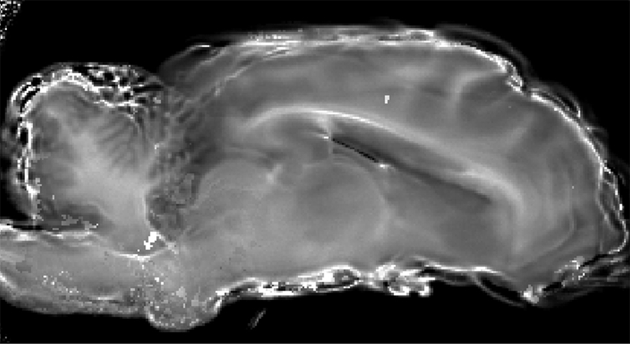 Parametric image of sheep brain